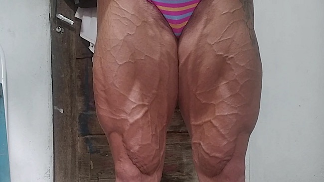 Vascular Post Contest 1